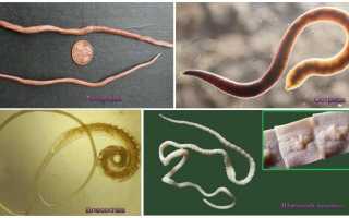 Как очиститься от паразитов в домашних условиях