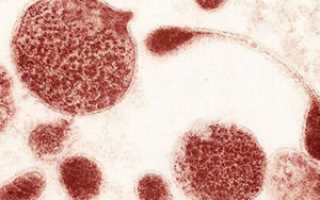 Уреаплазма специес у мужчин и женщин, какие симптомы заражения и методы лечения