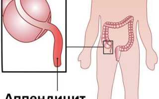 Причины и лечение частой рвоты у ребенка