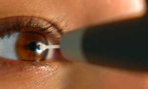 Виды тонометрии для исследования глаза