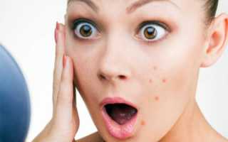 Лечение паразитов на лице человека