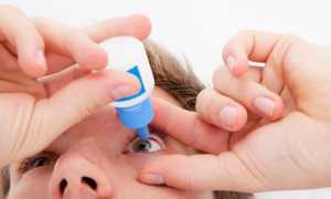 Лечение заболеваний глаз каплями диклофенак и т.д.