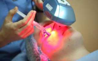 Положительное и негативное влияние лазерного излучения на организм человека