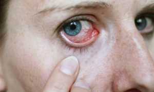 Виды глазных капель при конъюнктивите