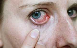 Виды глазных капель при конъюнктивите