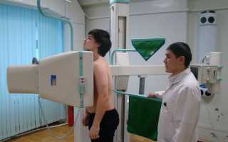 Есть ли вред от флюорографии