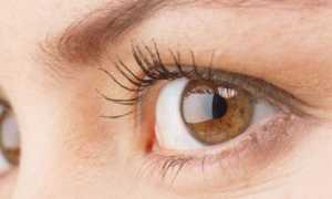 Характеристика афакии глаза и методы лечения