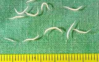 Как избавиться от зуда при острицах?