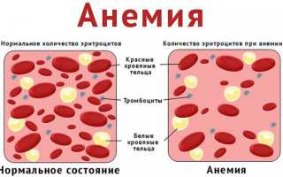 Интерстициальная миома матки малых размеров