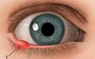 Особенности терапии чирья на глазу