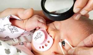 Причина ретинопатии у недоношенных детей