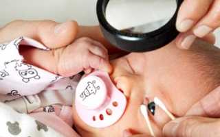 Причина ретинопатии у недоношенных детей