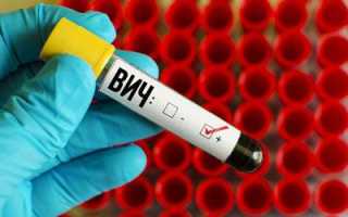 Причины и лечение инфекционно-токсического шока