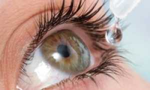 Список эффективных глазных капель для лечения близорукости