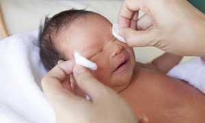 Лечение дакриоцистита с помощью массажа