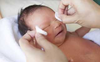 Лечение дакриоцистита с помощью массажа