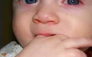 Народная медицина в лечении конъюнктивита у детей