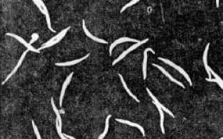 Острицы: что это такое, причины, признаки