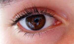 Конъюнктивит: симптомы, виды, диагностика, лечение