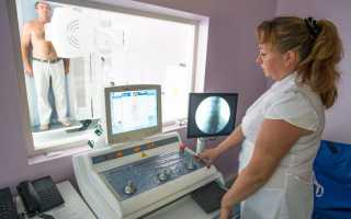 Какую дозу облучения человек получает при рентгене