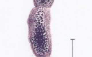 Эхинококк в печени, легких, сердце, головном мозге, почках, мышцах и костях