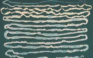 Широкий лентец: что это, причины, симптомы и лечение