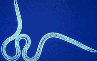 Филярии и филяриоз