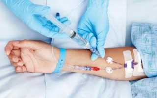 Капельницы при интоксикации и отравлении