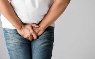 Воспаление промежностного шва у мужчин