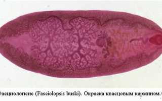 Возбудитель фасциолопсидоза и способы лечения заражения