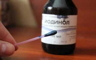 Какой вред здоровью может нанести йод