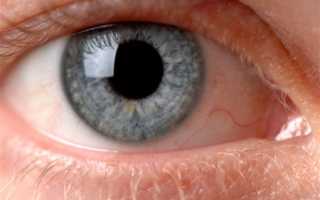 Что такое аккомодация глаза? По каким причинам может возникнуть нарушение?