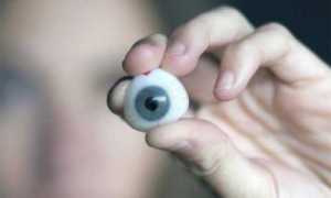 Виды близорукости и причины их возникновения