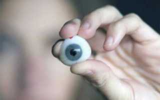 Виды близорукости и причины их возникновения