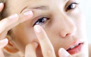 Линзы при астигматизме: виды, особенности подбора