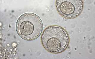 Крысиный цепень у человека и заболевания которые он вызывает