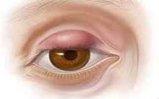 Показания к приему антибиотиков от ячменя