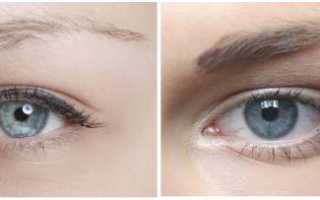Какие заболевания можно распознать по глазам?