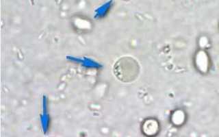 Норма бластоцисты у взрослого в кале, симптомы и лечение