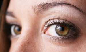 Закрытоугольная форма глаукомы, особенности лечения