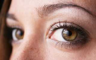 Закрытоугольная форма глаукомы, особенности лечения