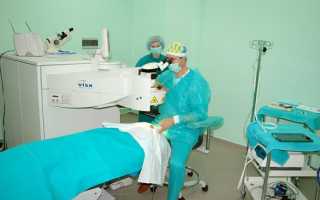 Коррекция косоглазия у взрослых с помощью операции