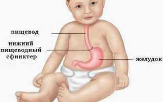 Особенности клинической картины и возможные причины рвоты у ребенка