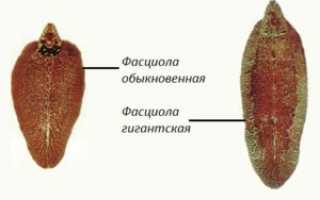 Печеночный сосальщик: строение, пути заражения, этапы развития, профилактика