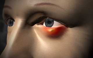 Тетрациклиновая мазь для лечения ячменя