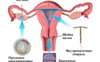 Чем вредны противозачаточные средства