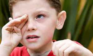 Симптомы нервного тика у ребенка