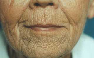 Лактомарин: польза и вред