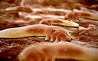 Паразиты в организме человека