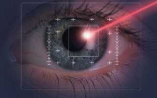 Методы лечения глаукомы: лазерная коррекция, капли, операции